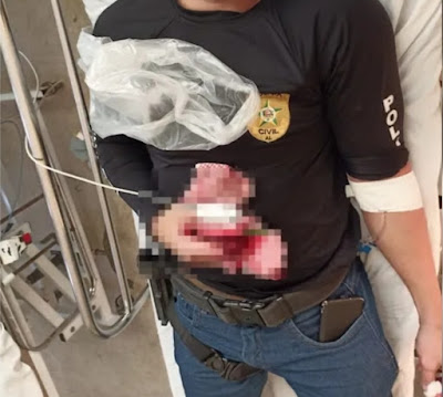 Policial Civil é baleado em Senador Rui Palmeira/AL durante prisão de filho suspeito de mandar matar o pai e comemorar crime