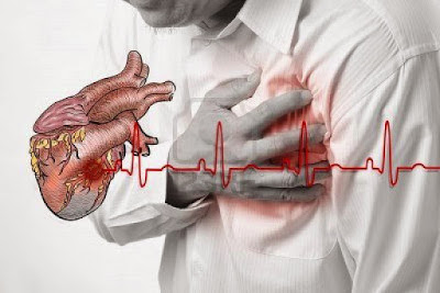  Cara Atasi Penyakit Jantung Menggunakan Ramuan Alami