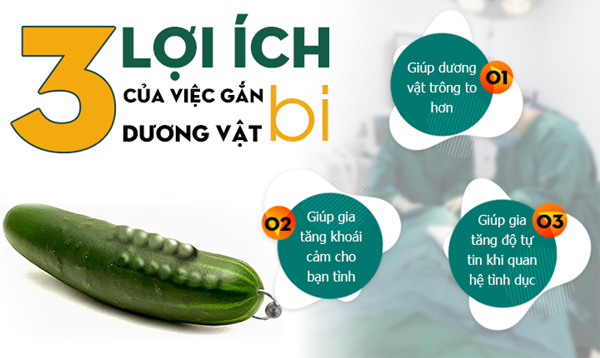 Gắn bi dương vật ở Nghệ An