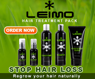 hair loss in men