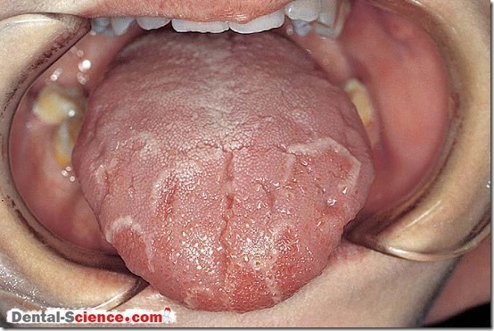  lengua geográfica FOTOS BUSCOIMAGENES COM (2)