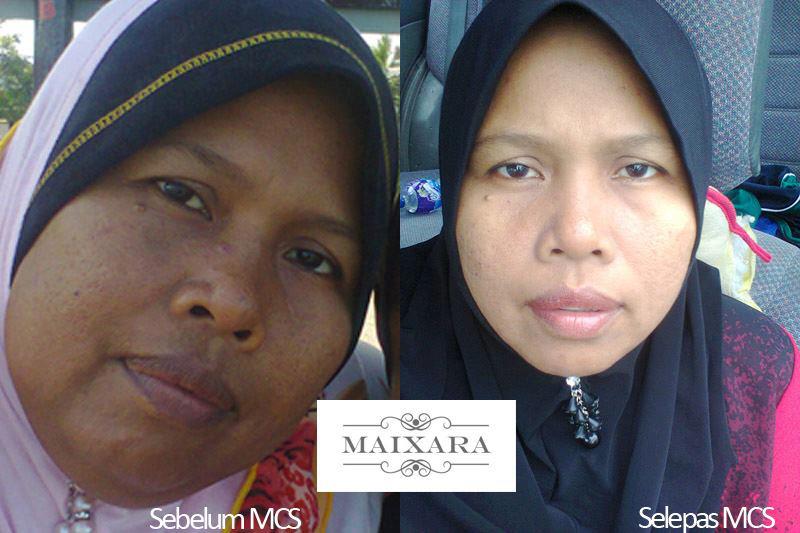 BARANGAN IBU DAN ANAK: TESTIMONI MAIXARA C-SENTIAL