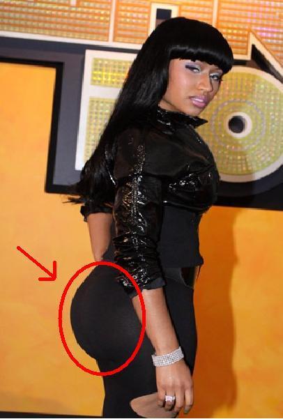 of Nicki Minaj's famous assets and before and after surgery pics too . The