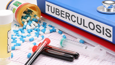 El Tratamiento y Prevención del Consumo (Tuberculosis)