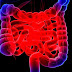 Inflammatory bowel disease