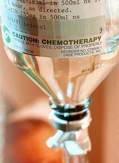 lösemi kemoterapi tedavisi