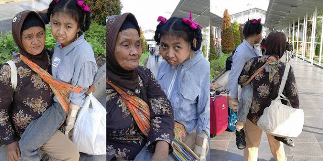 Kisah nenek gendong cucu usia 18 tahun dari Bogor berobat ke RSCM