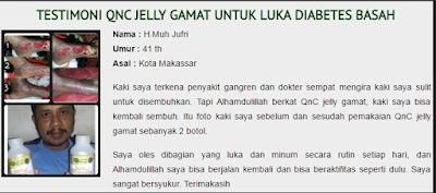 QNC JELLY GAMAT