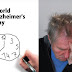 World's Alzheimer's Day, क्या होता है अल्जाइमर बीमारी, क्या है इसके लक्षण? जाने,