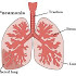 6 Nursing Diagnosis for Pneumonia