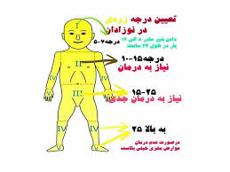 جدول زردی نوزادان