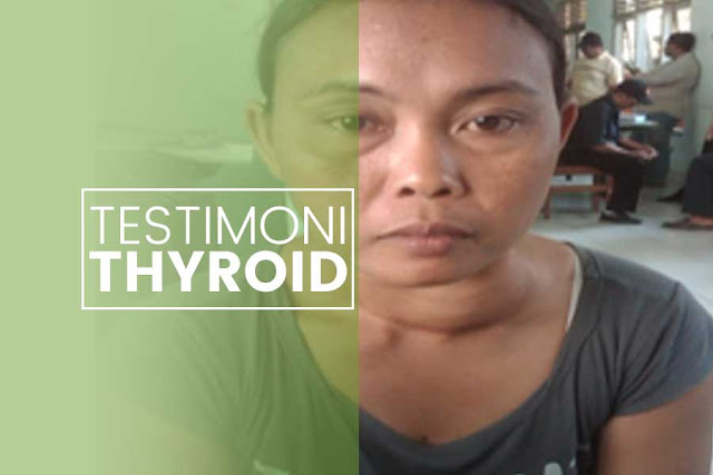 Sembuh dari Penyakit Thyroid dengan Obat Alami