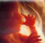 Embarazo: semanas 18 a 20. Cambios en el embrion. La modificacion ya no lo llamamos embrion ahora lo llamamos feto. Como cambia nuestro bebe. Modificaciones en el organismo. Semana 18, 19 y 20. Primer trimestre de embarazo. Pasamos al segundo trimestre. Concepcion. cuidados del bebe. embrion. feto. modificaciones. crecimiento. formacion de la piel. formacion de los organos vitales. como va creciendo. peso y tamaño. como se alimenta. cordon umbilical. miembros. se forma su carita. perfil. ecografias. examenes clinicos. padres y madres. planificacion familiar. enfermedades. problemas en el embarazo. trastornos y a nomalias. proteccion infantil. hermanos. familias. crecimiento familiar. quiero tener un hijo. cuando tener un hijo. relaciones sexuales. sexualidad. sexo del bebe. la decision de ser padres. primeras ocho semanas, qua hacer antes de quedar embarazada, fecha de nacimiento. fecundacion. higiene. cambios en la madre. Enfermedades de transmisión sexual. Embarazo: semanas 18 a 20. Cambios en el embrion. La modificacion ya no lo llamamos embrion ahora lo llamamos feto. Como cambia nuestro bebe. Modificaciones en el organismo. Semana 18, 19 y 20. Primer trimestre de embarazo. Pasamos al segundo trimestre. Concepcion. cuidados del bebe. embrion. feto. modificaciones. crecimiento. formacion de la piel. formacion de los organos vitales. como va creciendo. peso y tamaño. como se alimenta. cordon umbilical. miembros. se forma su carita. perfil. ecografias. examenes clinicos. padres y madres. planificacion familiar. enfermedades. problemas en el embarazo. trastornos y a nomalias. proteccion infantil. hermanos. familias. crecimiento familiar. quiero tener un hijo. cuando tener un hijo. relaciones sexuales. sexualidad. sexo del bebe. la decision de ser padres. primeras ocho semanas, qua hacer antes de quedar embarazada, fecha de nacimiento. fecundacion. higiene. cambios en la madre. Enfermedades de transmisión sexual. Embarazo: semanas 18 a 20. Cambios en el embrion. La modificacion ya no lo llamamos embrion ahora lo llamamos feto. Como cambia nuestro bebe. Modificaciones en el organismo. Semana 18, 19 y 20. Primer trimestre de embarazo. Pasamos al segundo trimestre. Concepcion. cuidados del bebe. embrion. feto. modificaciones. crecimiento. formacion de la piel. formacion de los organos vitales. como va creciendo. peso y tamaño. como se alimenta. cordon umbilical. miembros. se forma su carita. perfil. ecografias. examenes clinicos. padres y madres. planificacion familiar. enfermedades. problemas en el embarazo. trastornos y a nomalias. proteccion infantil. hermanos. familias. crecimiento familiar. quiero tener un hijo. cuando tener un hijo. relaciones sexuales. sexualidad. sexo del bebe. la decision de ser padres. primeras ocho semanas, qua hacer antes de quedar embarazada, fecha de nacimiento. fecundacion. higiene. cambios en la madre. Enfermedades de transmisión sexual.
