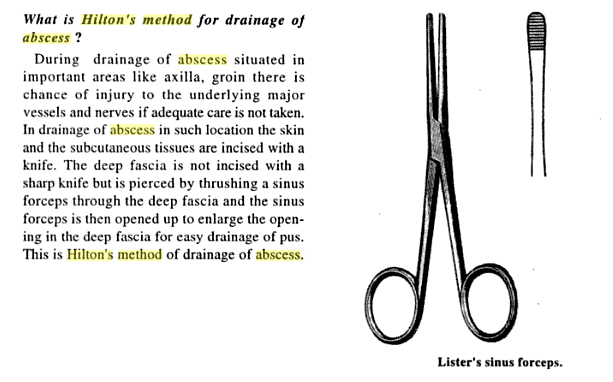 hiltons method