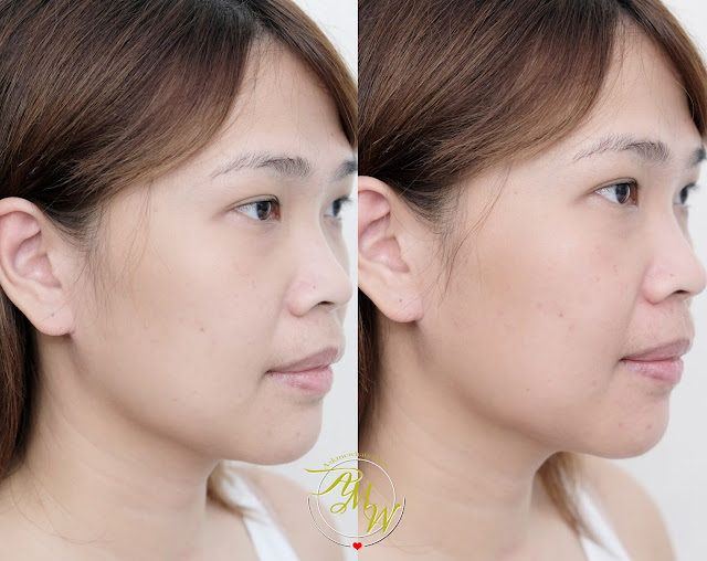 before and after photo of Happy Skin Beauty Anti-Aging Line