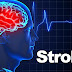 STROKE : SYMPTOMS:; CAUSES AND RISK FACTORS |FINDYOURSELF