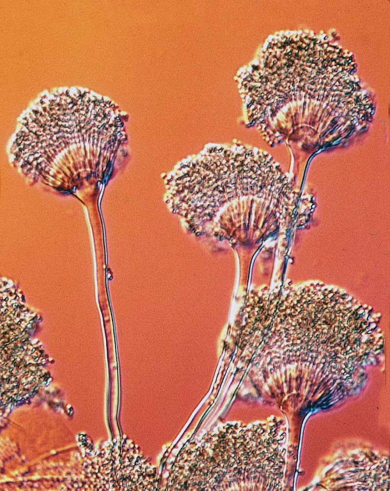 Terbaru 56 Gambar Jamur Aspergillus