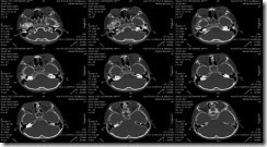 pemeriksaan radiology dengan ct scan