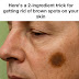 Here’s a 2-ingredient hack for getting rid of brown spots on your skin