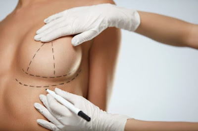 Breast Reconstruction in Turkey