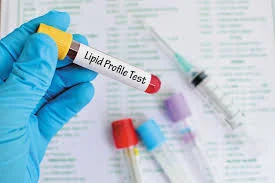 Lipid Profile Test