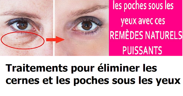 Eliminer les cernes et les poches sous les yeux avec ces remèdes naturels puissants