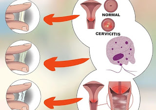 woman's menstrual cycle