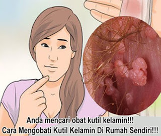 Pengobatan kutil kelamin tanpa operasi di surabaya, pengobatan kutil kelamin wanita, obat kutil kelamin atau kutil di kemaluan ampuh bagus, obat kutil kelamin atau kutil di kemaluan kaskus, obat kutil kelamin alami dari tumbuhan, pengobatan tradisional kutil kelamin atau kutil di kemaluan luar, cara mengobati kutil pada kelamin, apa nama obat kutil kelamin atau kutil di kemaluan, obat untuk kutil kelamin luar, obat cina kutil kelamin atau kutil di kemaluan, obat penghilang kutil di kelamin