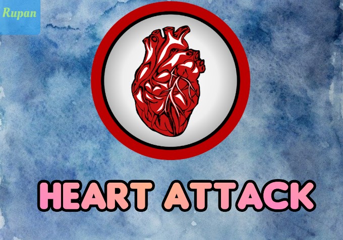 Heart attack