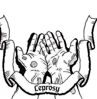 leprosy day is important