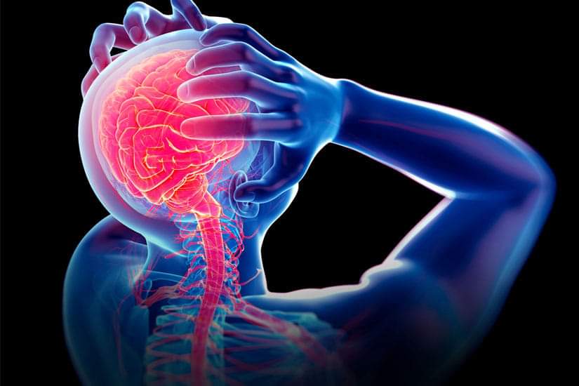 Cara Menghilangkan Sakit Migrain ~ shidarahmat