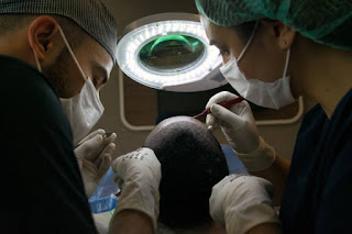 Hair Transplant Treatment in Delhi