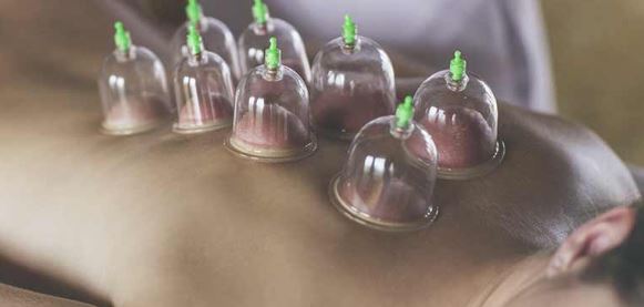 Benefits of Hijama mentioned in Islam
