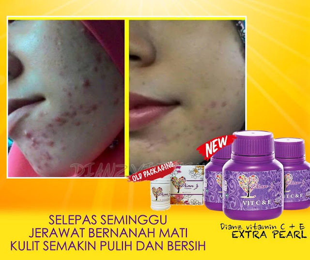 Nano Lightener Cream Dianz Pixy / Dian Vitamin C & E Extra Pearl / Nano Removal Cream Murah - Hair Removal