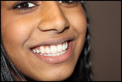 braces 0014_resize