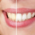 Tips para blanquear los dientes de forma natural