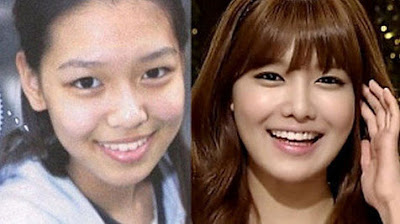 Sooyoung Girls Generation Before After