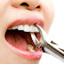 Nhổ răng cấm hàm dưới có nguy hiểm không?