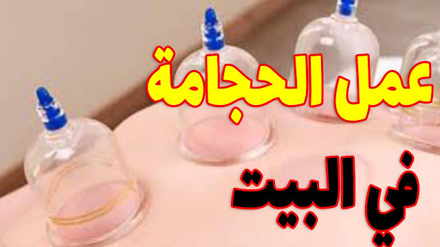 طريقة عمل الحجامة في المنزل