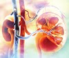 Chronic Kidney disease