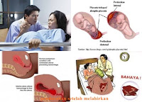 http://naturalmedicineindo.blogspot.com/2015/06/pengobatan-alami-untuk-pendarahan-setelah-melahirkan.html