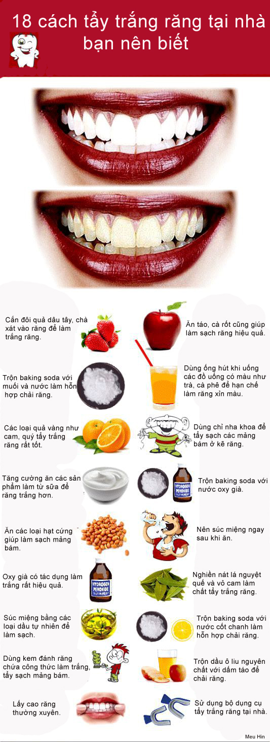 Phương pháp tẩy trắng răng hiệu quả tại nhà