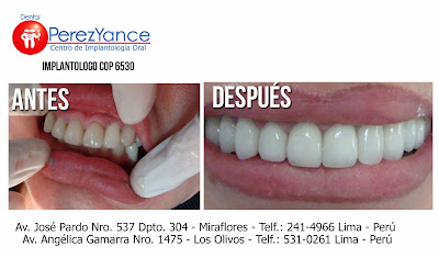  www.dentalperezyance.com