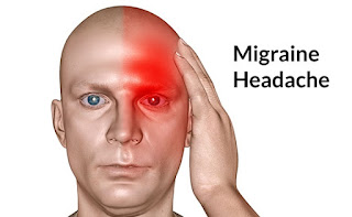 Gejala Dan Solusi Terbaik Pengobatan Migraine