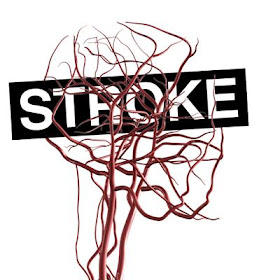 Obat kimia stroke ringan, resep obat herbal stroke, pengobatan alternatif stroke di jakarta timur, ciri2 penyakit stroke, mengobati stroke iskemik, apakah penyakit stroke, cara mengobati stroke mata, ilmu pengobatan stroke, obat stroke de nature, obat stroke dokter, pengobatan stroke dengan akupuntur
