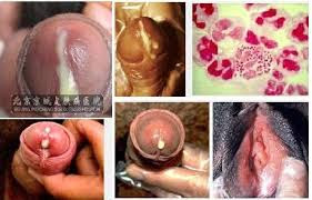 Obat Alami Lubang Penis Merah Sakit Buat Kencing dan Keluar Nanah