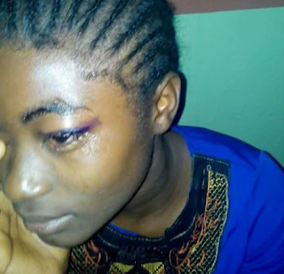 Nigerian girl survives fatal accident that claimed lives of all passenger