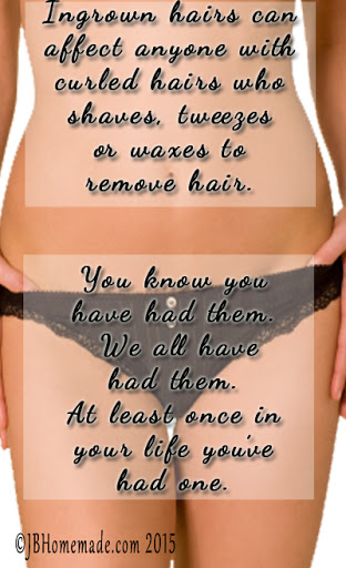 Ingrown hairs can affect anyone with curled hairs who shaves, tweezes or waxes to remove hair.