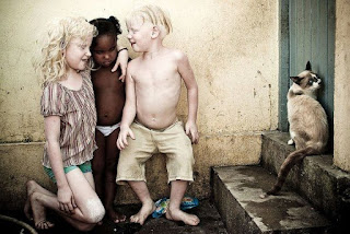 O fotógrafo Alexandre Severo, um dos passageiros do acidente aéreo em Santos, é o autor do maravilhoso trabalho “À Flor da Pele”, em que retratou o dia a dia de irmãos albinos em uma família negra. Dos cinco irmãos, três sobrevivem fugindo da luz, procurando alegria no escuro.Descrição: fotografia mostra três crianças, com os pés descalços sujos, próximas a uma parede encardida: A menor, uma garotinha negra, está em pé entre os dois irmãos albinos, ela usa apenas uma calcinha branca; à esquerda, a irmã albina ajoelhada à altura da irmã negra, enlaça-lhe carinhosamente o pescoço com o braço esquerdo, ela usa uma blusa listrada em branco e marrom e short verde; à direita, o irmão albino está em pé com joelhos levemente flexionados, usa apenas bermuda bege. Atrás do seu pé esquerdo, um saco azul de salgadinhos abandonado no chão. Os irmãos albinos estão sorrindo, com olhos fechados e rostos direcionados à irmã negra que está séria e observa o chão molhado; à direita, próximo a eles, um gato siamês no segundo degrau, encostado a uma porta. A pele extremamente alva e os cabelos louros claríssimos dos irmãos albinos contrastam com a pele negra e os cabelos escuros da irmã menor.