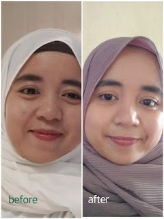Review Kojie.san Skin Lightening Soap dan body lotion